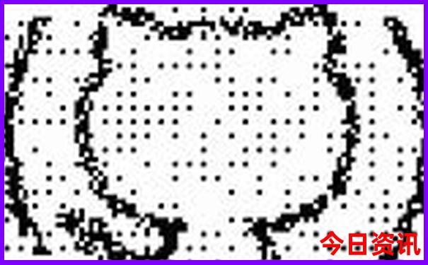 北京排名前十肠道医院